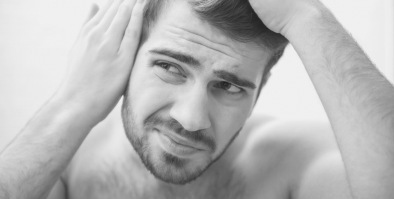Diagnóstico y tratamientos de alopecia