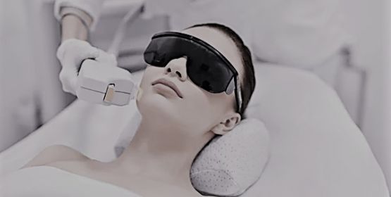  Rejuvenecimiento facial ipl